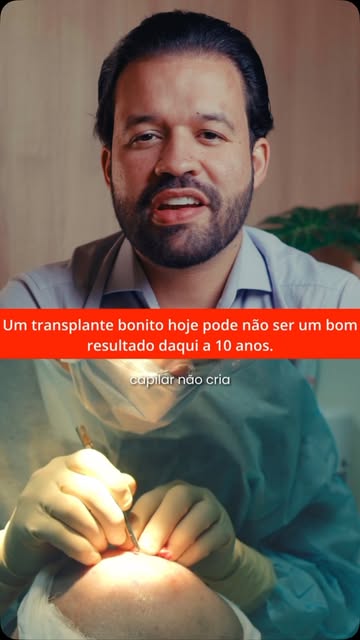 Transplante capilar vai muito além de recuperar os fios. É sobre resgatar a confiança e a autoestima