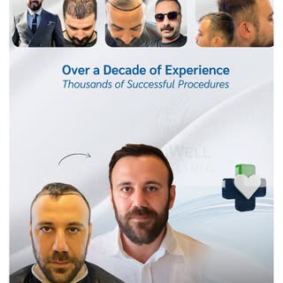 Experience matters when it comes to hair restoration.

With over a decade of experience and thousand