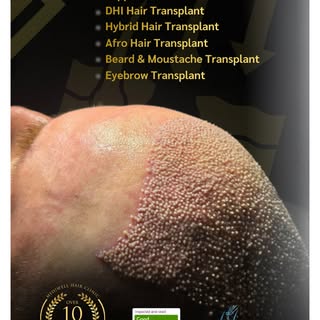 Modern techniques. Thoughtful execution.

At Mediwell Hair Clinic, we offer a range of advanced hair
