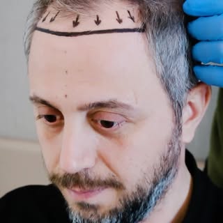 Designed around the person, not the procedure.

Hair restoration should work with what is already th
