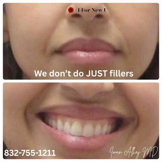 At I For New U Clinic, we do more than just fillers — we provide comprehensive, patient-focused aest