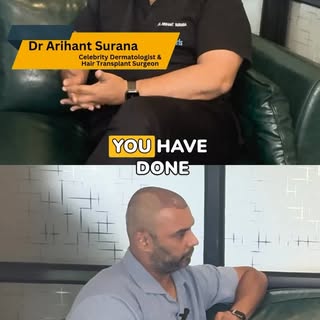 Why STUART BINNY and his cricketer colleagues always choose Monaris hair clinic and Dr. Arihant Sura