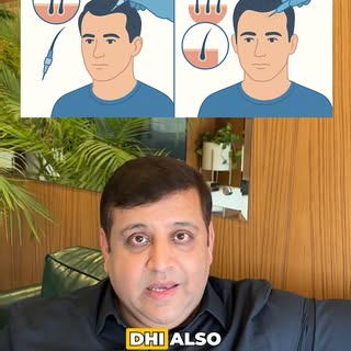 🚨 FUE vs DHI Hair Transplant — Are They Really Different? 🤔
Watch this video where Dr. Arihant Sur