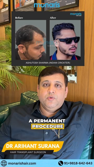 🚨 Hair Transplant vs Hair Wig – What Should You Choose?🤔

In this video, Dr. Arihant Surana explai