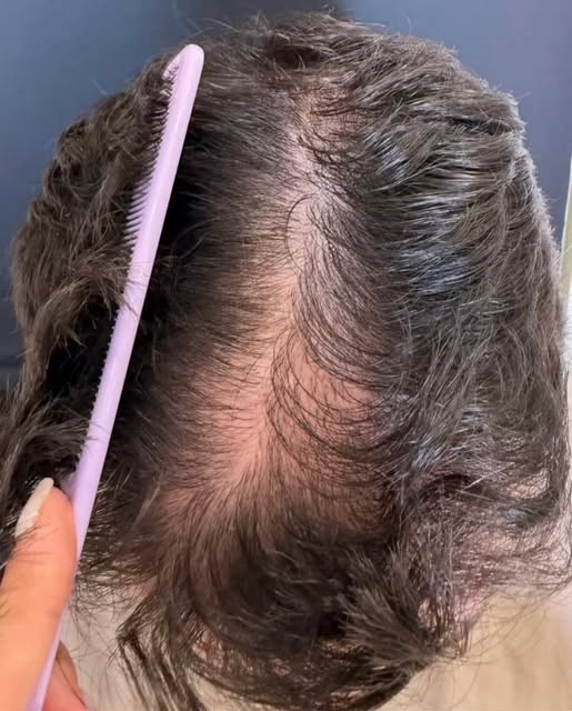 Mismo pelo. Más densidad. 
Un resultado totalmente natural 👌🏻 

Así puede cambiar la imagen del ca