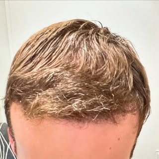 Faites glisser ⬅️ pour découvrir une autre transformation incroyable, seulement 6 mois après une gre