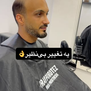 به فکر تغییر باش👌

#پروتز #پروتز_دائمی_مو #پروتزمو_طبیعی_دائم #پروتزمو_دائم #کاشتمو