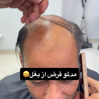 ملدمو قرض از بغل نزنید بیایید‌پروتز کنید😀

site:iranporotez
phone:📞 09354148915
follow:@iranporote