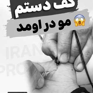 اونایی که انجام دادن میدونن گره زدن‌مو چه کار سختیه😀

#پروتز #پروتزمو_طبیعی_دائم #ترمیم_مو #کاشت #پ