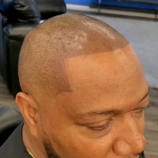 Check out these amazing results!  No🚫dye 🚫Fibers 🚫spray.  The permanent, Royal SMP Solution, that