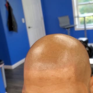 Check out these amazing results!  No🚫dye 🚫Fibers 🚫spray.  The permanent, Royal SMP Solution, that