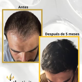 ✨ El cambio de Gerardo, a solo 5 meses 🙌

Cada proceso es distinto, pero ver la evolución de nuestr