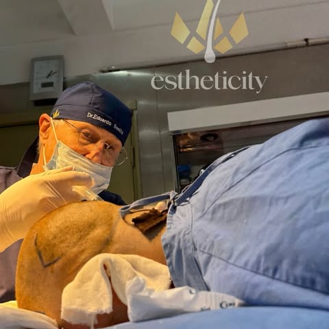 🩺 La experiencia médica también forma parte de un implante capilar.

Cada paciente tiene caracterís