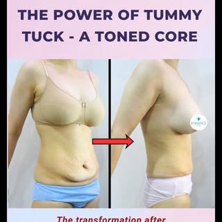 𝐓𝐡𝐞 𝐏𝐨𝐰𝐞𝐫 𝐨𝐟 𝐚 𝐓𝐨𝐧𝐞𝐝 𝐂𝐨𝐫𝐞 

A 𝘁𝘂𝗺𝗺𝘆 𝘁𝘂𝗰𝗸 does more than just remove exc