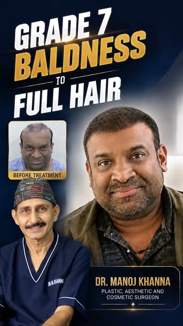 Hair Transplant in Kolkata — 9 years later, is the hair still there?

Soumya Bose had his hair trans