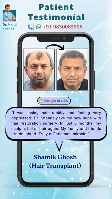 “Dr. Khanna gave me new hope. In just 8 months, my scalp is full of hair again. Truly a Christmas mi