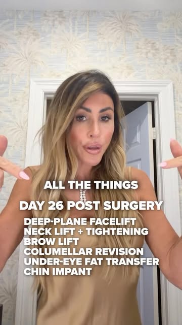 Here’s what 51 looks like, four weeks out from a facelift. 💕

Day 26 of my Facelift Diaries! I’m st