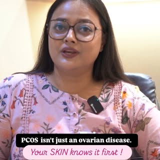 PCOS is more than an ovarian disorder. Infact skin and hair signs can appear years before ovarian ch