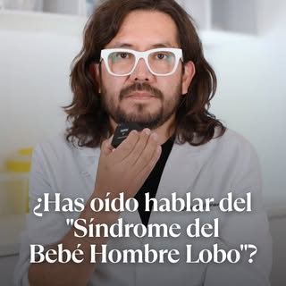 ¿Habías oído hablar del “síndrome del bebé hombre lobo”?

Aunque suene alarmante, los casos más cono