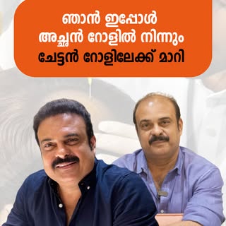 അഭിനേതാവ് ആനന്ദ് തൃശ്ശൂർ, Xenofolix-ൽ നിന്ന് ഹെയർ ട്രാൻസ്പ്ലാന്റ് ചെയ്ത് അത്യുഗ്രൻ റിസൾട്ട് കിട്ടി❤️