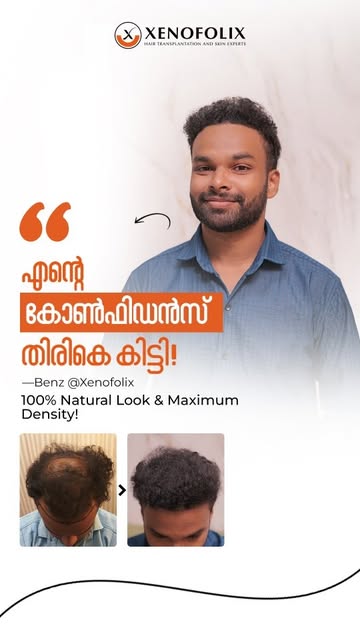 Transform your look, restore your confidence. 🔥

True confidence comes from results you can see. Wa
