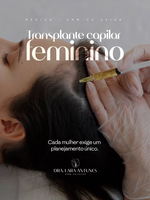 O transplante capilar feminino não é uma adaptação do procedimento masculino.

A linha frontal preci