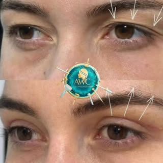 #browlifting #eyebrowlift #eyebrowshaping #eyebrowshape #eyebrowstyling