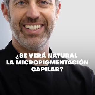 Cuando un experto en Micropigmentación Capilar con la destreza de Miguel Granados lleva a cabo el pr