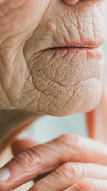 As rugas ao redor da boca começaram a ficar mais marcadas? ✨

O Laser CO₂ pode ser uma opção para me