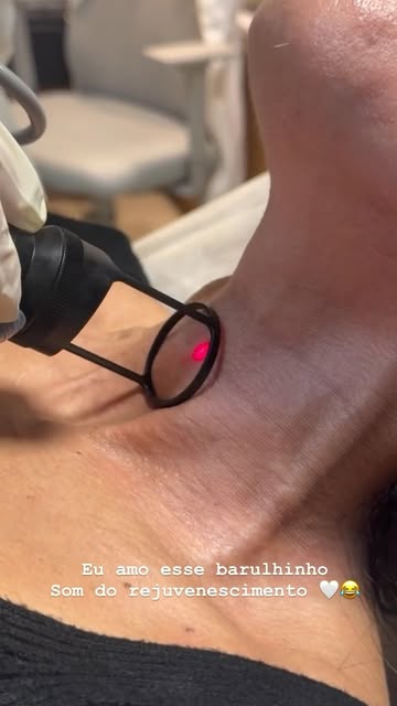 O pescoço também merece atenção quando o assunto é rejuvenescimento. ✨

O laser CO₂ pode ser uma opç