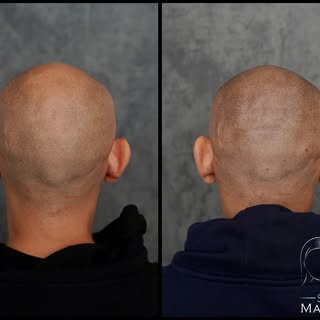 Night-and-day difference. Natural feather and impactful reframing of the face.
.
.
.
.
.

▪️Ready to