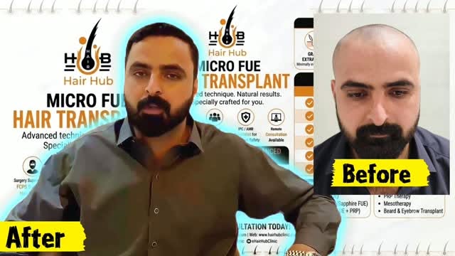 100% Natural Hair Growth | Patient Feedback at Hair Hub 💥

​Real Results, Real Confidence! 🌟
Dekhi