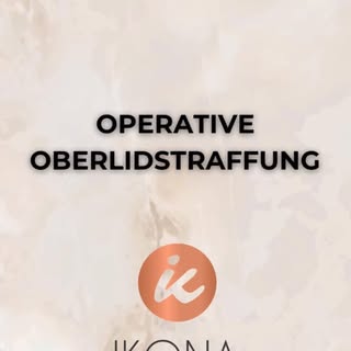 Einblicke in die Erfahrung unserer zufriedenen Patientin nach einer Oberlidstraffung. 👁✨
Vielen Dan