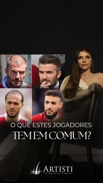 A calvície não escolhe profissão, idade ou estilo de vida.

Ao longo dos anos, vários jogadores conh
