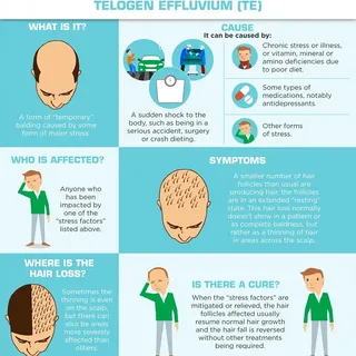 Most common  cause of hair fall easily treatable.