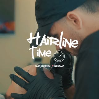 It’s Hairline Time ⏰

With SMP (cosmetic hair tattoo), we can create a realistic looking hairline fo