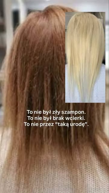 To nie szampon z reklam. 
To nie kolejna wcierka z drogerii, na którą wydajesz ostatnie oszczędności