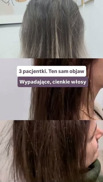 Trzy różne kobiety. Ten sam objaw. Trzy zupełnie różne wyniki badań i trzy zupełnie różne przyczyny 
