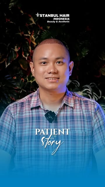 4300 grafts kemudian… mulai chapter baru! 🔥

Jujur, awalnya sempat mikir-mikir juga buat hair trans