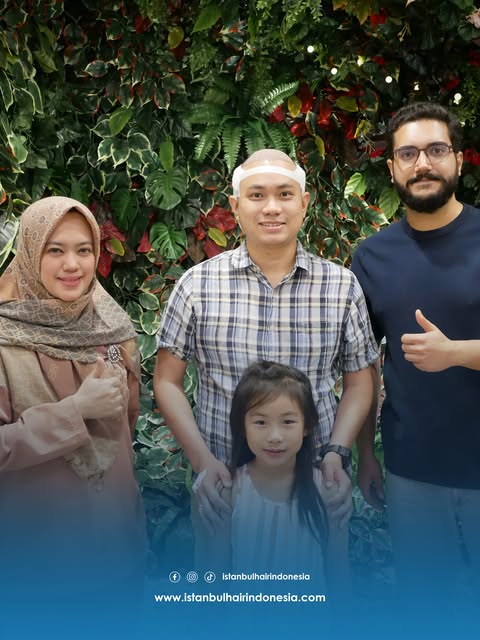 ✨ 4.300 Grafts | Jakarta, Indonesia 🇮🇩

Satu langkah baru untuk perjalanan rambut yang lebih perca