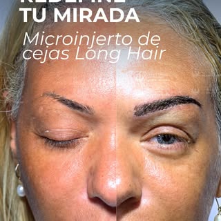 Hay frases que resumen exactamente lo que significa un microinjerto de cejas.

Porque no se trata so