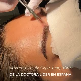 Resultados extraordinarios empiezan por elegir a la Doctora líder en España 👀

Hacerte un microinje