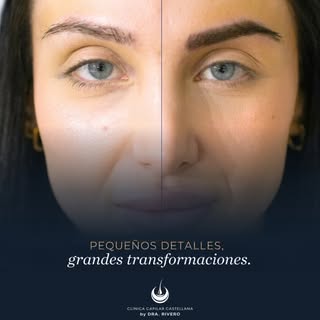 No transformamos cejas. Transformamos expresiones.

Cada uno de estos casos ha sido diseñado y reali