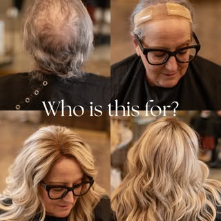 Can we talk about this for a second? 🤍

Hair thinning and hair loss can happen for so many differen