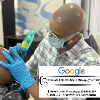 At work ✍️

📍Emulate Follicles l Scalp Micropigmentation l Bangalore, India