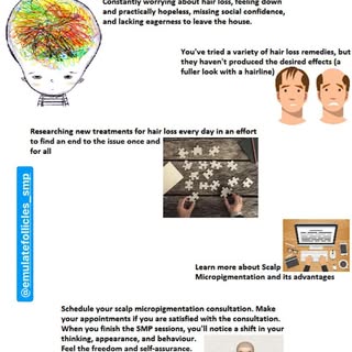 Hairloss is a choice, keep it or defeat it with Scalp Micro-pigmentation.

Contact us for a free con