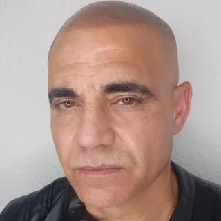 Después de investigar varias opciones, decidió probar la micropigmentación capilar para recuperar su