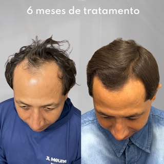 Mais um caso de Tratamento Clínico que tivemos uma melhora gigantesca, quando o tratamento é especia