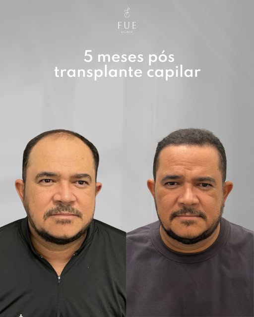 5 meses depois de uma decisão que mudou a forma como ele se olhava, e claro, como ele se sentia. Ain