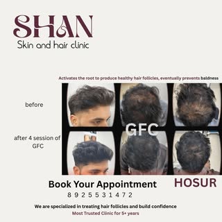 GFC treatment result at Hosur clinic